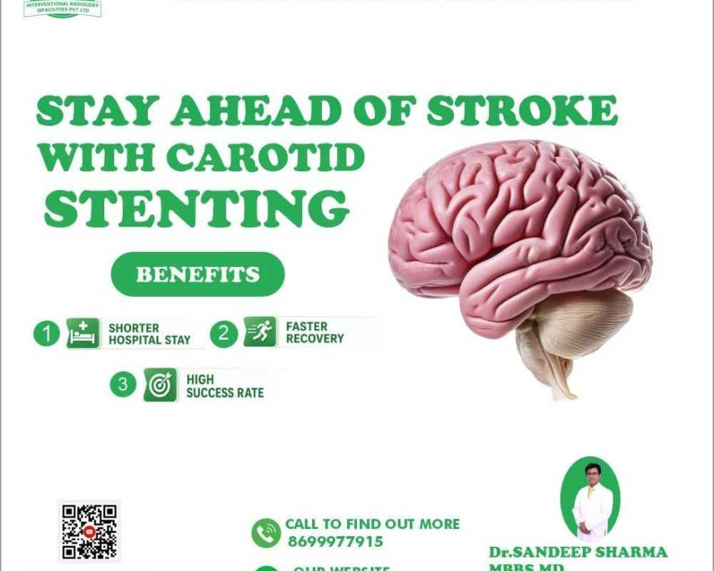 carotid-artery-stenosis-treatment-for-better-brain-functioning