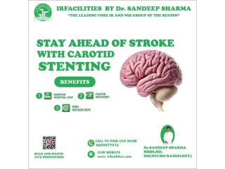 carotid-artery-stenosis-treatment-for-better-brain-functioning-small-0