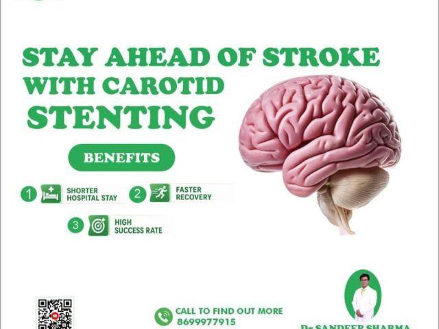 carotid-artery-stenosis-treatment-for-better-brain-functioning