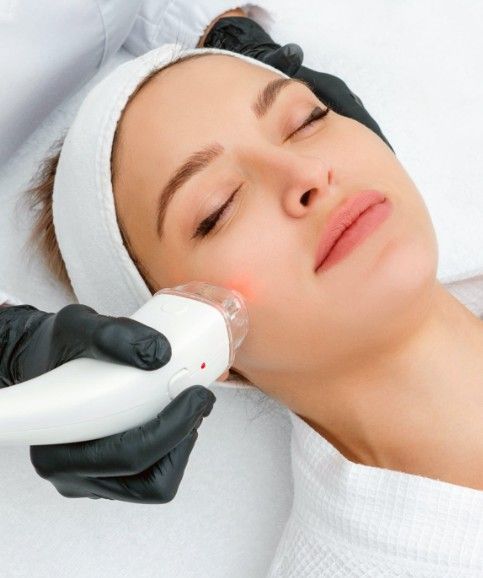 laser-skin-resurfacing-treatment-services-in-alexandria-virginia-big-0