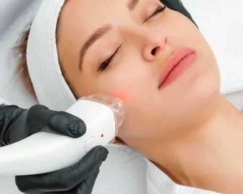 laser-skin-resurfacing-treatment-services-in-alexandria-virginia