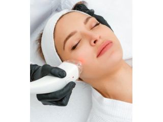 laser-skin-resurfacing-treatment-services-in-alexandria-virginia-small-0