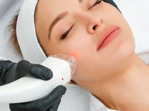 laser-skin-resurfacing-treatment-services-in-alexandria-virginia