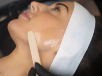 skin-laxity-treatments-fort-collins-tighten-and-restore-skin