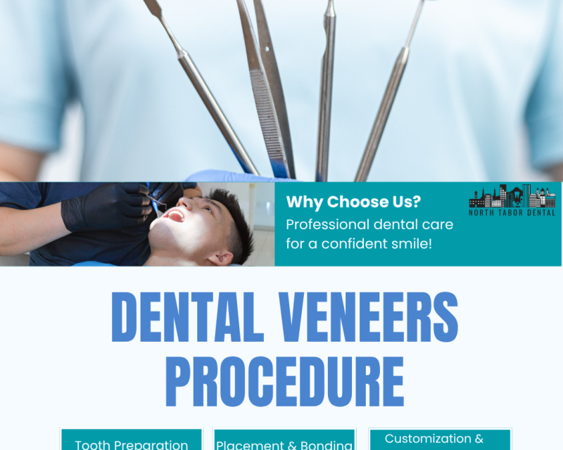 are-dental-veneers-procedure-painful