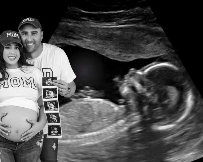 which-place-offers-gentle-and-caring-baby-ultrasounds