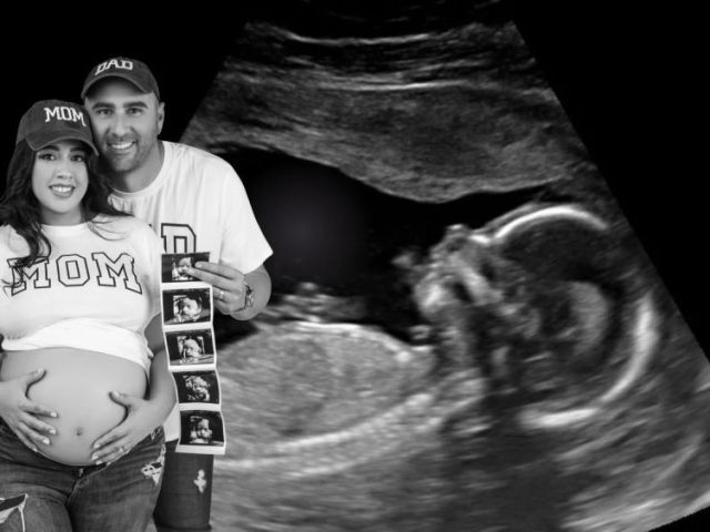 which-place-offers-gentle-and-caring-baby-ultrasounds