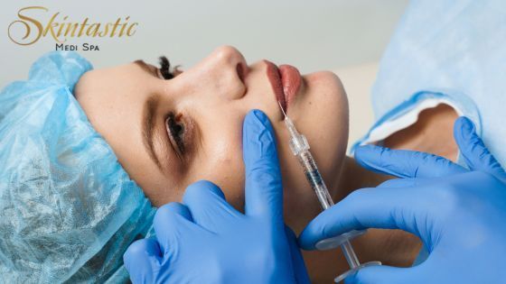 best-lip-fillers-riverside-for-fuller-and-smooth-lips-big-0