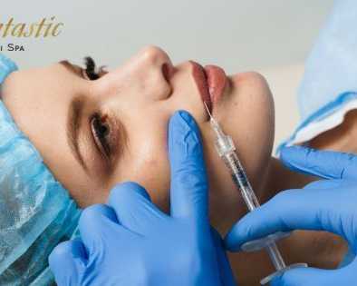 best-lip-fillers-riverside-for-fuller-and-smooth-lips