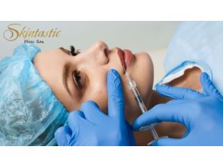 best-lip-fillers-riverside-for-fuller-and-smooth-lips-small-0