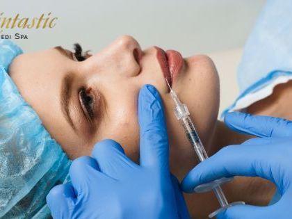 best-lip-fillers-riverside-for-fuller-and-smooth-lips