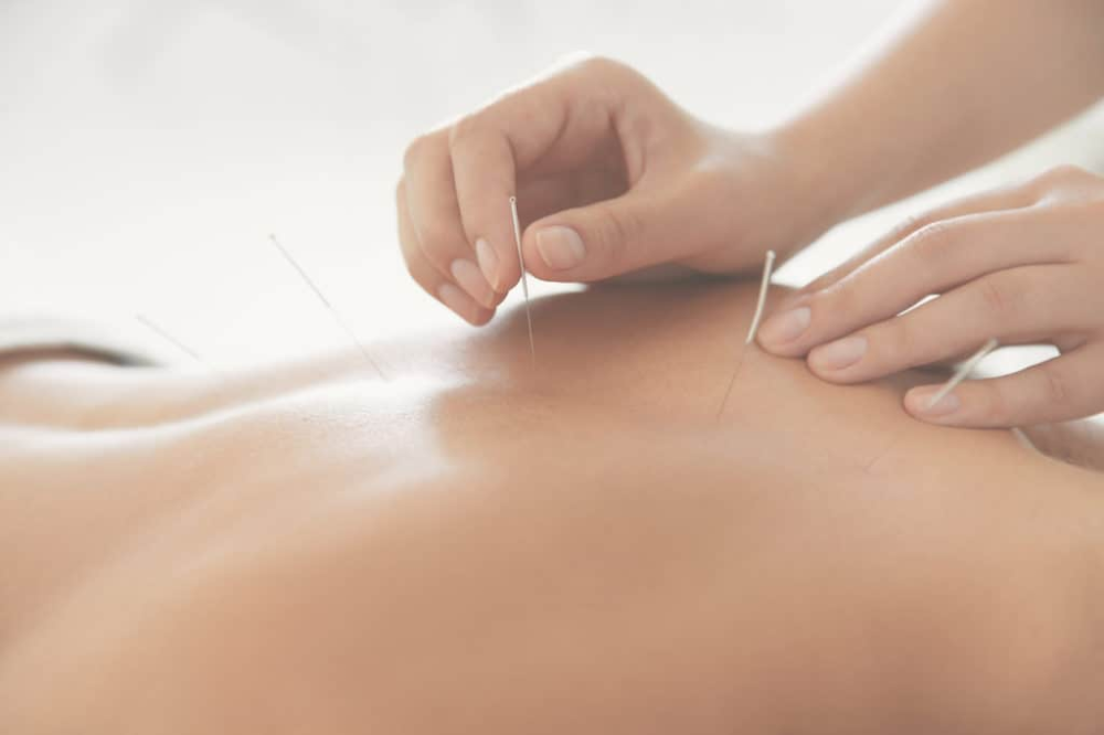 pain-management-acupuncture-in-nyc-back-neck-sciatica-relief-big-0
