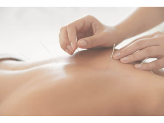 pain-management-acupuncture-in-nyc-back-neck-sciatica-relief-small-0