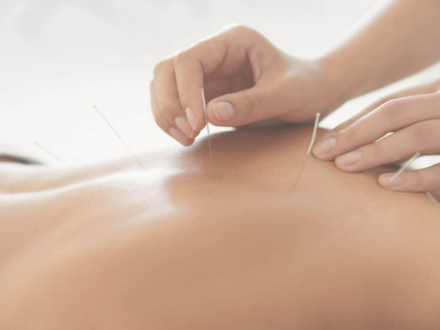 pain-management-acupuncture-in-nyc-back-neck-sciatica-relief