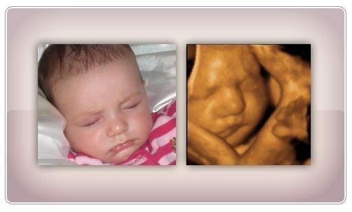 accurate-early-gender-dna-test-services-in-anaheim-california-big-0