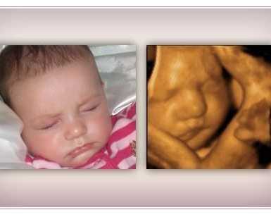 accurate-early-gender-dna-test-services-in-anaheim-california