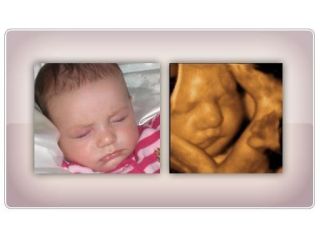 accurate-early-gender-dna-test-services-in-anaheim-california-small-0