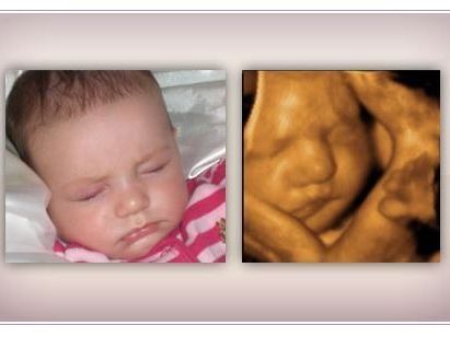 accurate-early-gender-dna-test-services-in-anaheim-california