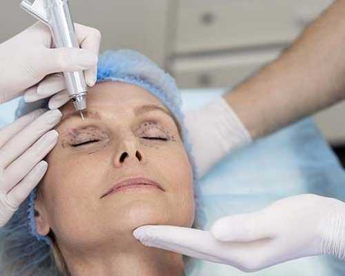 eyelid-surgery-in-richmond-va-for-brighter-youthful-eyes