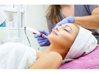 customized-microneedling-skin-treatment-for-healthier-small-0