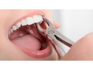 single-tooth-extraction-procedure-pinefield-dental-small-0