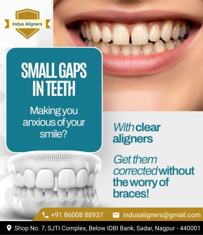 professional-teeth-straightening-in-nagpur-for-healthy-smiles-big-0