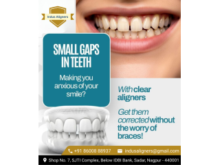 professional-teeth-straightening-in-nagpur-for-healthy-smiles-small-0