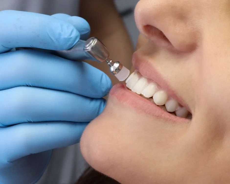 trusted-teeth-cleaning-seattle-clinic-for-complete-dental-care