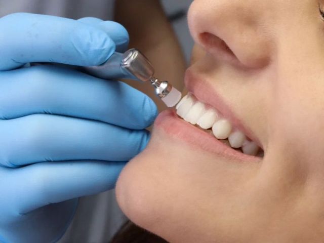 trusted-teeth-cleaning-seattle-clinic-for-complete-dental-care