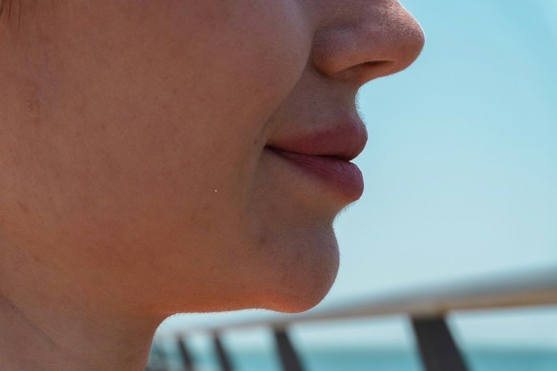double-chin-reduction-san-mateo-sculpt-big-0