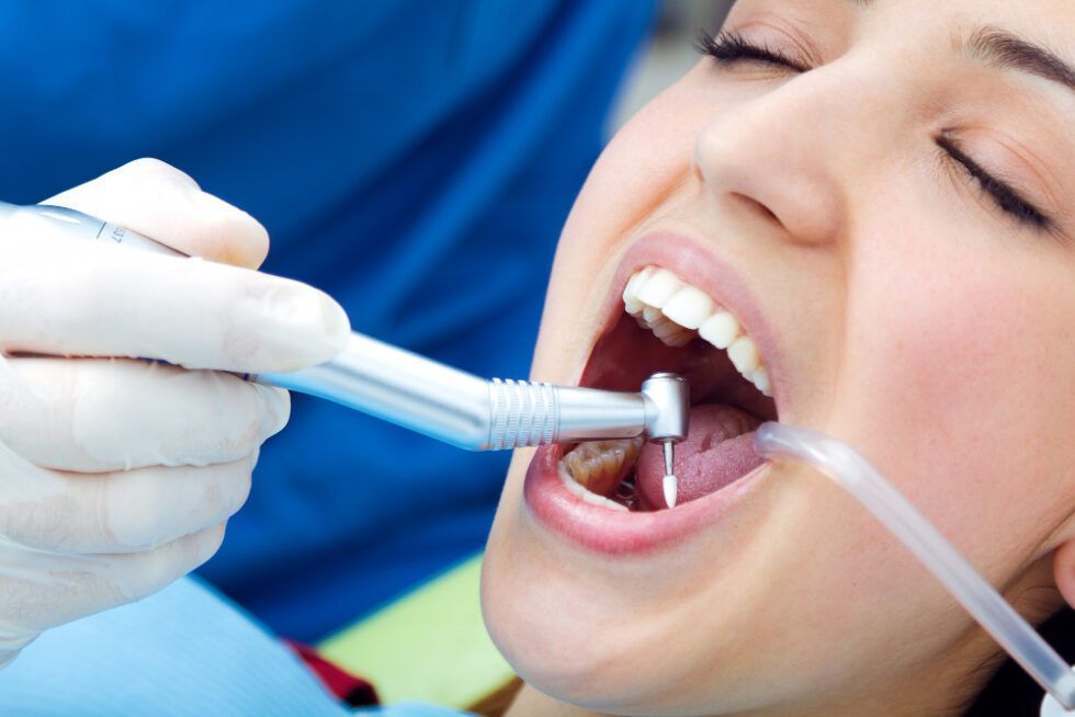 restore-your-smile-with-expert-dental-fillings-in-league-city-big-0