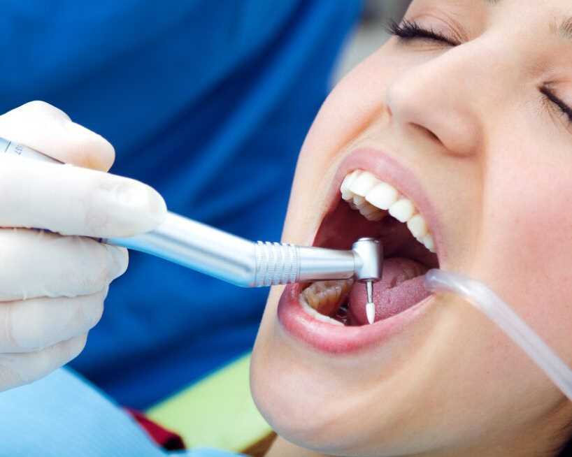 restore-your-smile-with-expert-dental-fillings-in-league-city