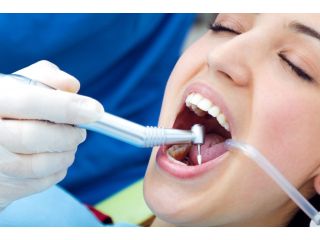 restore-your-smile-with-expert-dental-fillings-in-league-city-small-0