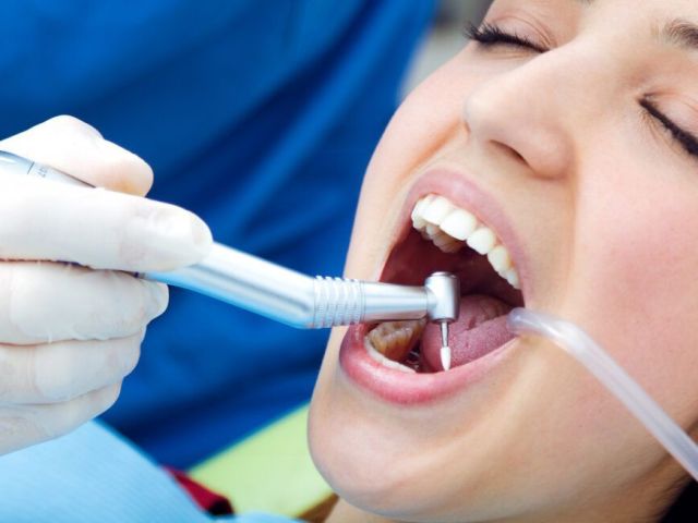restore-your-smile-with-expert-dental-fillings-in-league-city