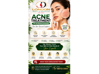 acne-treatment-in-bommasandra-london-porlour-small-0
