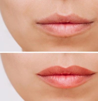 how-a-skin-treatment-clinic-can-help-you-look-younger-big-0