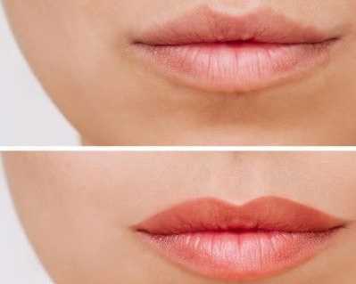 how-a-skin-treatment-clinic-can-help-you-look-younger