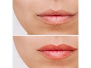 how-a-skin-treatment-clinic-can-help-you-look-younger-small-0