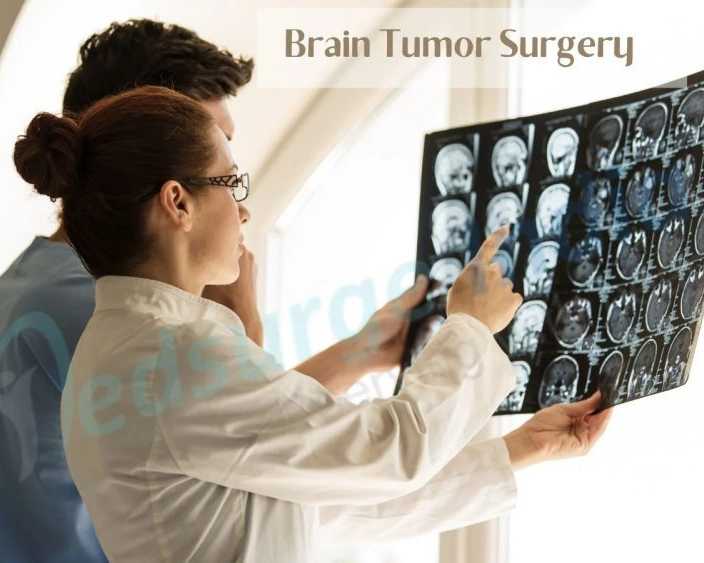 brain-tumor-surgery-cost-in-india