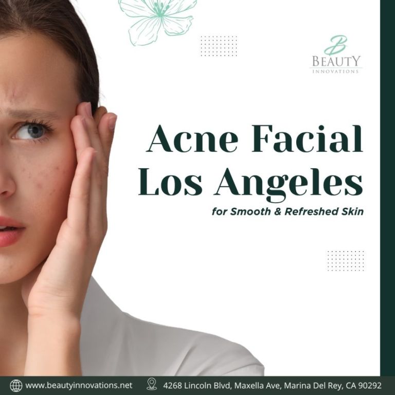 acne-facial-los-angeles-for-smooth-refreshed-skin-big-0