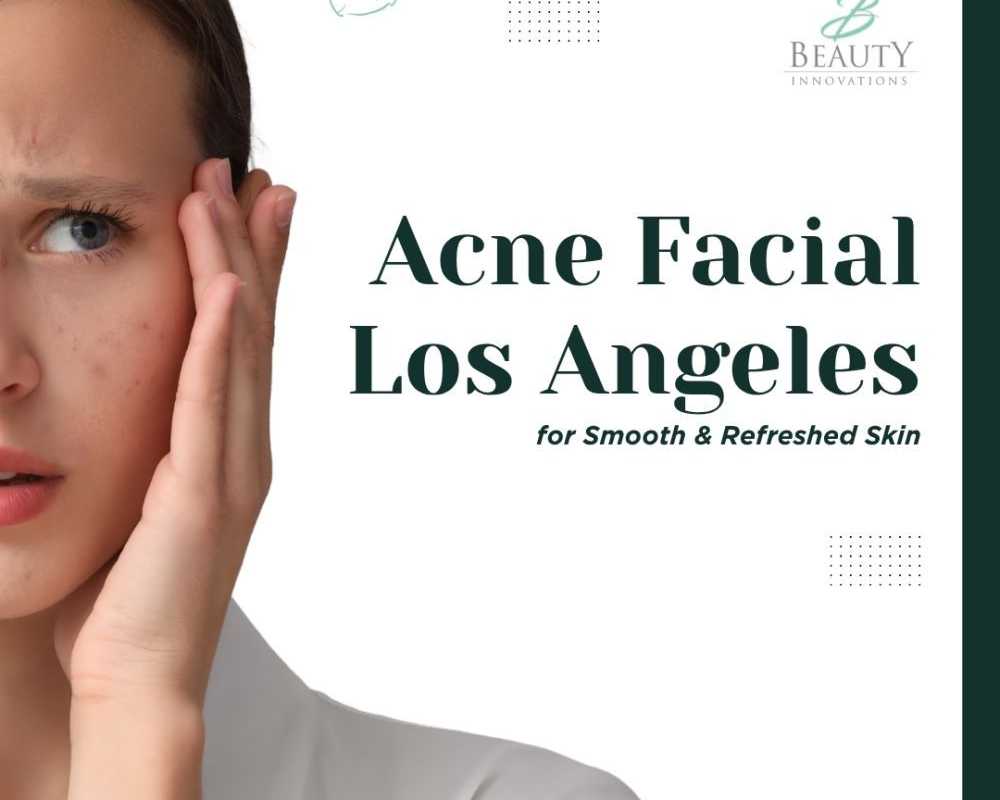 acne-facial-los-angeles-for-smooth-refreshed-skin