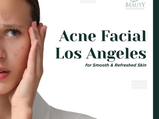 acne-facial-los-angeles-for-smooth-refreshed-skin