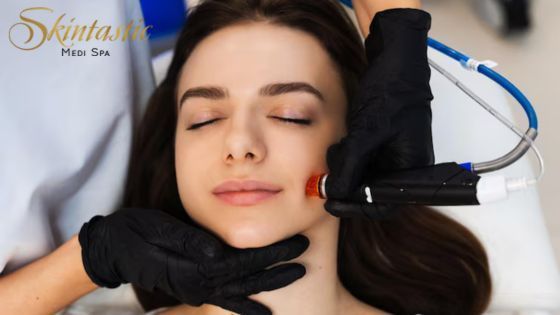best-hydrafacial-in-riverside-for-glowing-and-healthy-skin-big-0