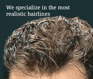 best-hair-systems-for-men-for-a-natural-hairline-big-0