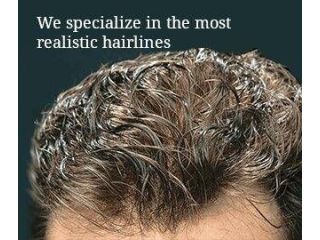 best-hair-systems-for-men-for-a-natural-hairline-small-0