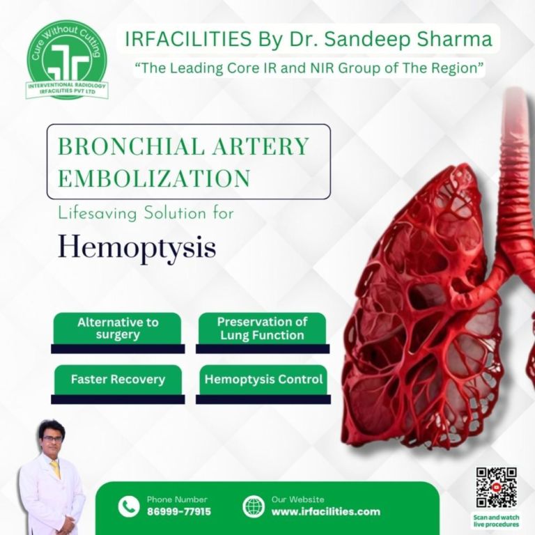 effectiveness-of-bronchial-artery-embolization-treatment-big-0