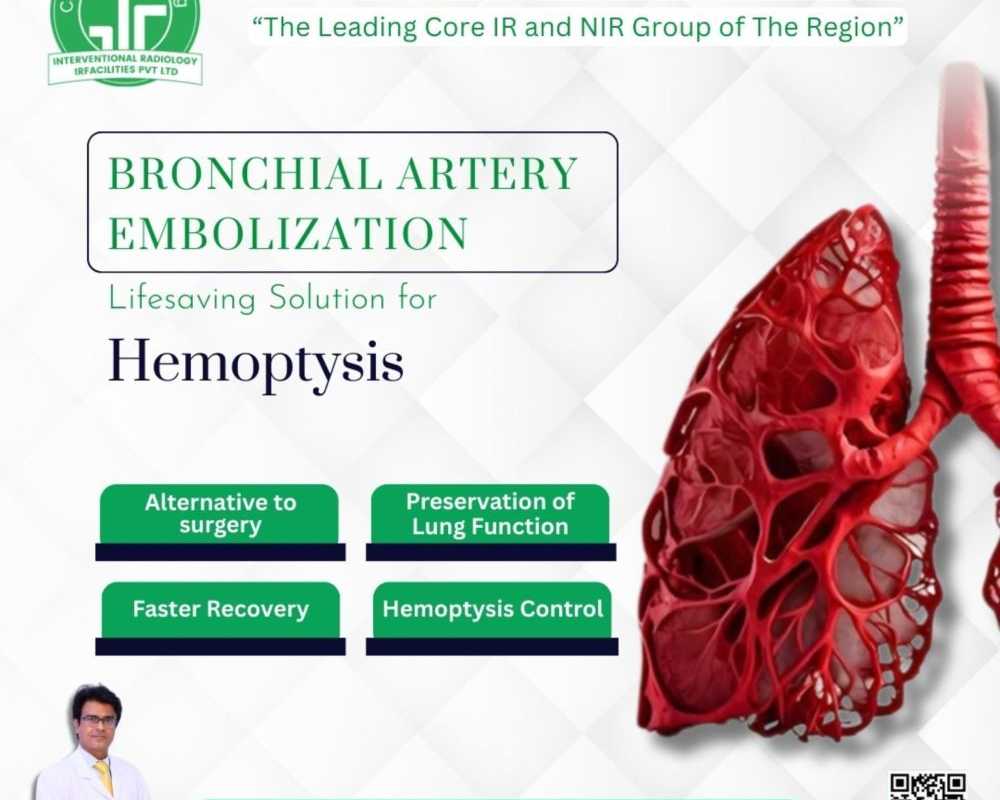 effectiveness-of-bronchial-artery-embolization-treatment