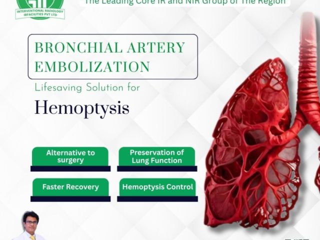 effectiveness-of-bronchial-artery-embolization-treatment