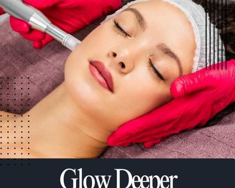 glow-deeper-with-microneedling-prp