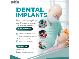 signs-your-dentures-implants-recovery-is-progressing-normally-small-0
